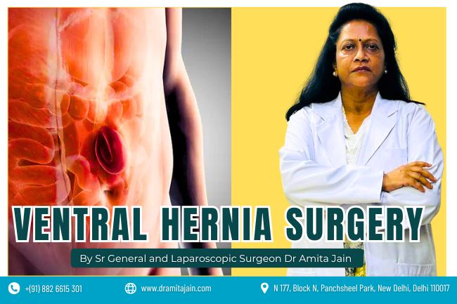ventral Hernia doctor and Surgeon Dr Amita Jain Dr Amita Jain best surgeon for ventral hernia in Delhi and India